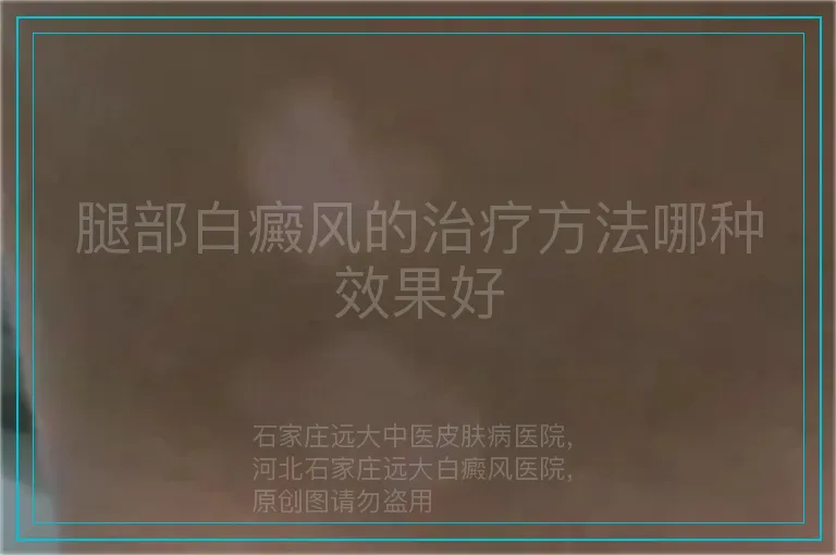 腿部白癜风的治疗方法哪种效果好