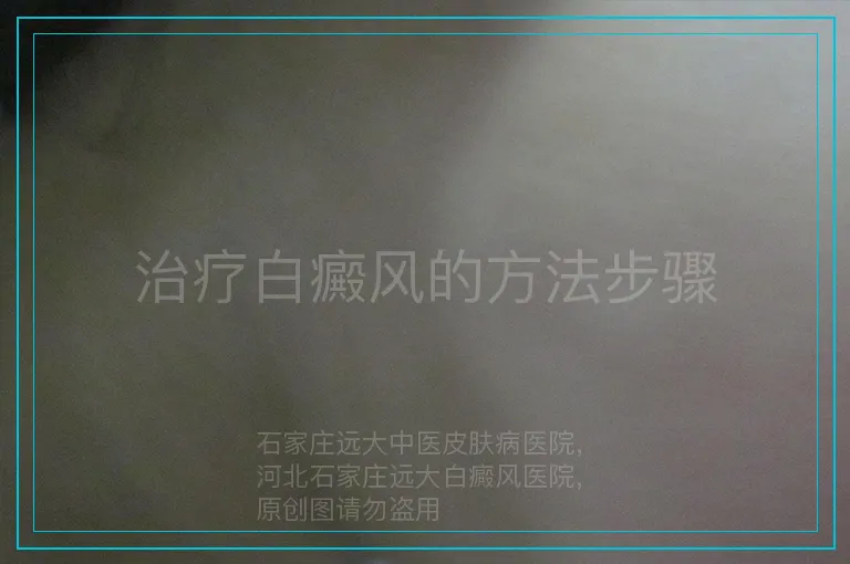 治疗白癜风的方法步骤