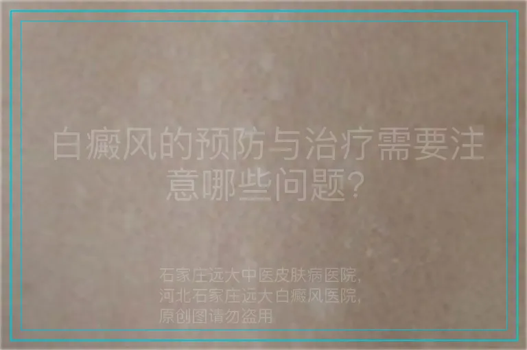 白癜风的预防与治疗需要注意哪些问题?