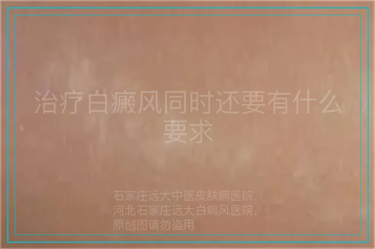 治疗白癜风同时还要有什么要求
