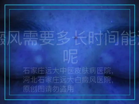 白癜风需要多长时间能治好呢