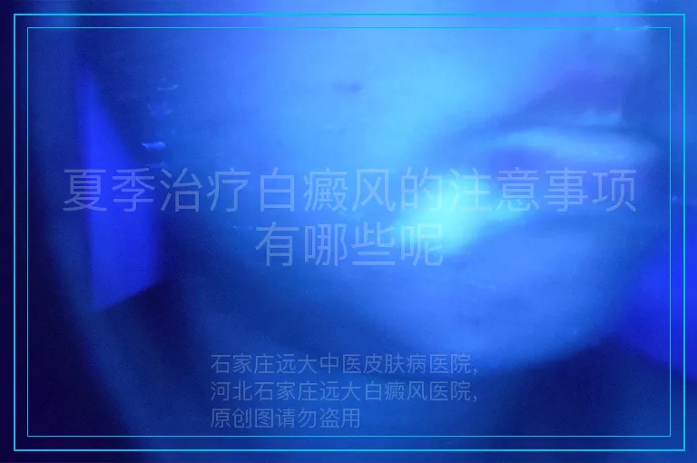 夏季治疗白癜风的注意事项有哪些呢