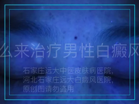 怎么来治疗男性白癜风呢