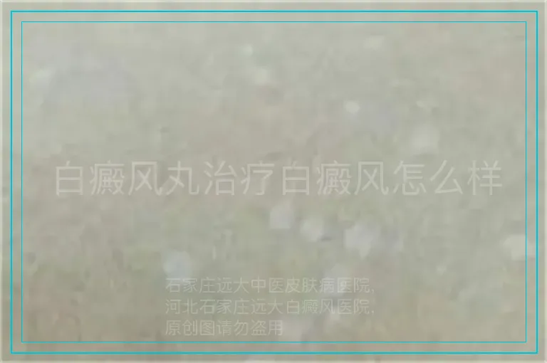 白癜风丸治疗白癜风怎么样