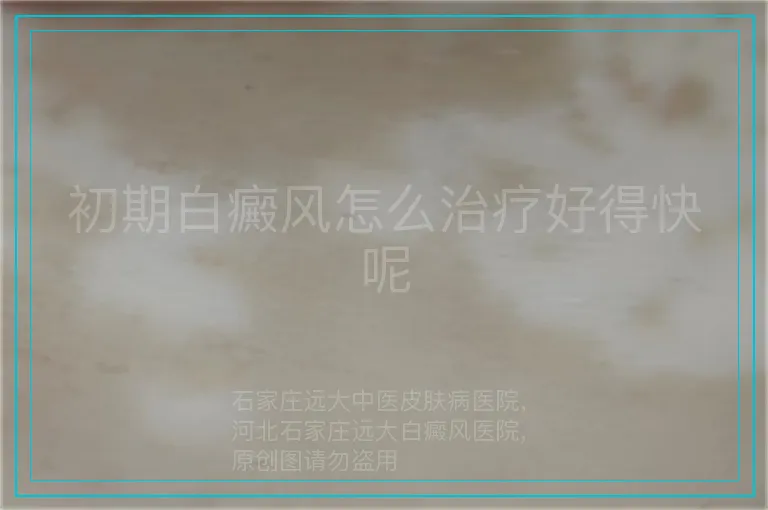 初期白癜风怎么治疗好得快呢