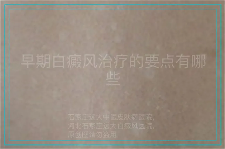 早期白癜风治疗的要点有哪些