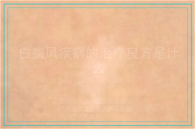 白癜风疾病的治疗良方是什么