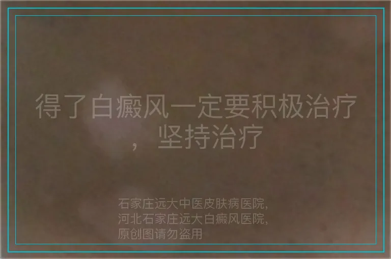 得了白癜风一定要积极治疗,坚持治疗