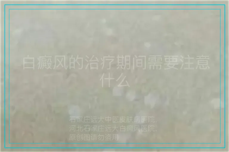 白癜风的治疗期间需要注意什么