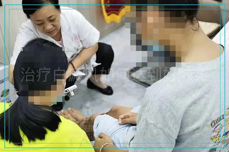 治疗白癜风如何达到好效果