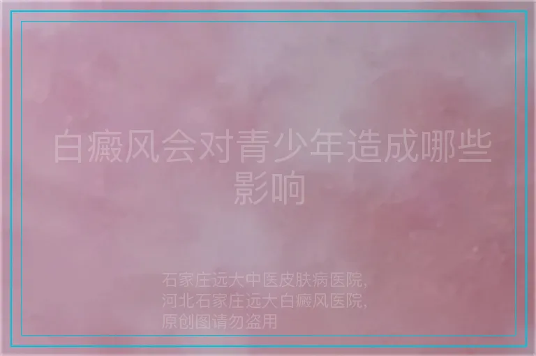 白癜风会对青少年造成哪些影响