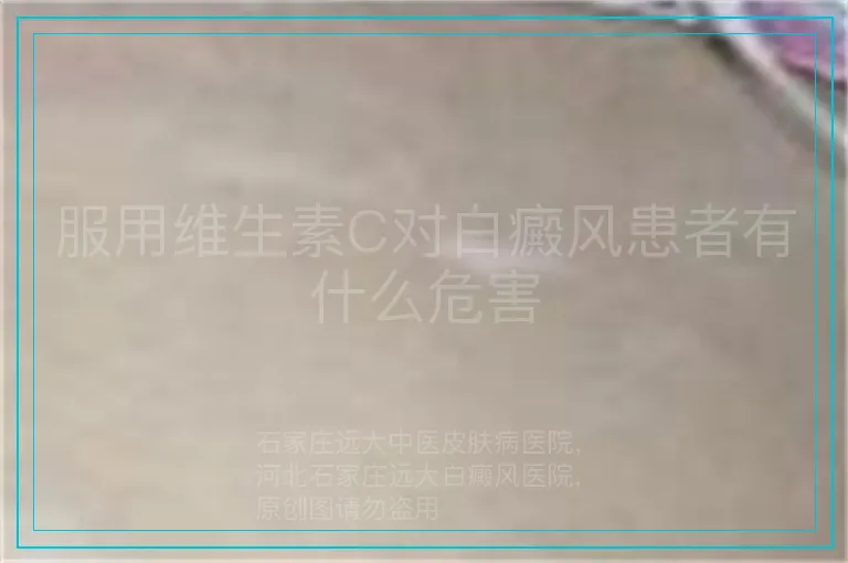 服用维生素C对白癜风患者有什么危害