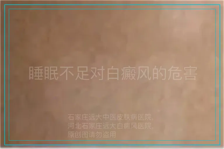 睡眠不足对白癜风的危害