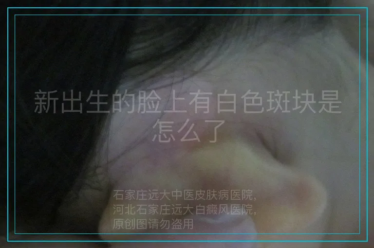 新出生的脸上有白色斑块是怎么了