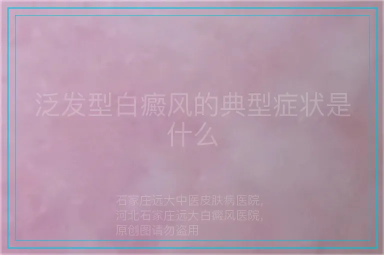 泛发型白癜风的典型症状是什么