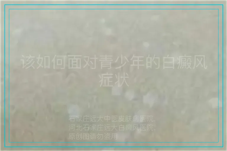 该如何面对青少年的白癜风症状