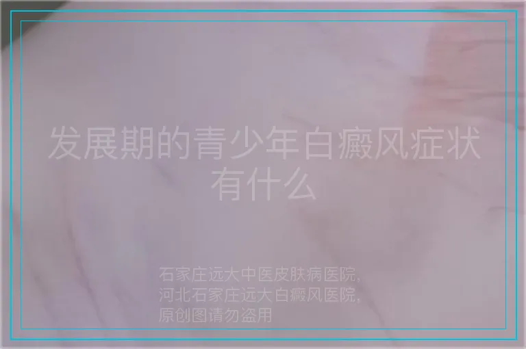 发展期的青少年白癜风症状有什么