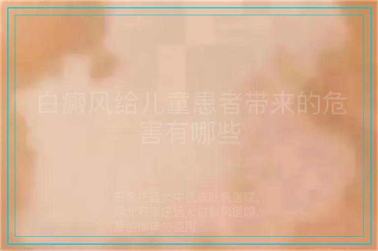 白癜风给儿童患者带来的危害有哪些