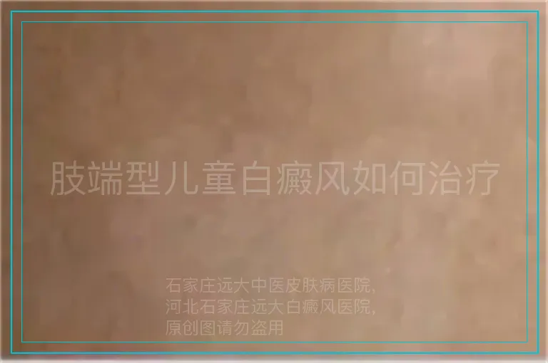 肢端型儿童白癜风如何治疗
