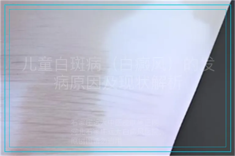 儿童白斑病（白癜风）的发病原因及现状解析