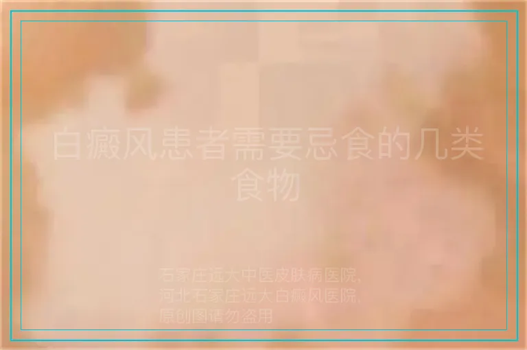 白癜风患者需要忌食的几类食物