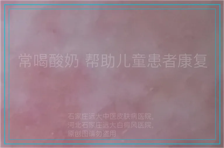 常喝酸奶 帮助儿童患者康复