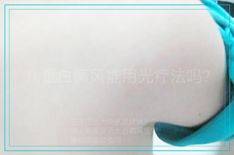 儿童白癜风能用光疗法吗？