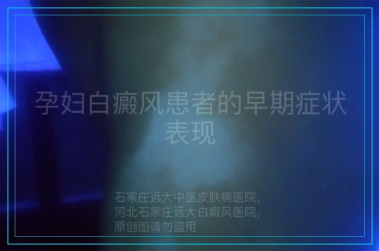 孕妇白癜风患者的早期症状表现