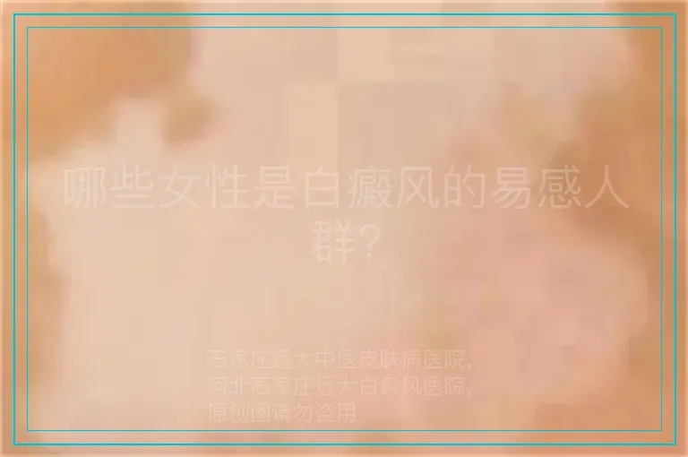 哪些女性是白癜风的易感人群?