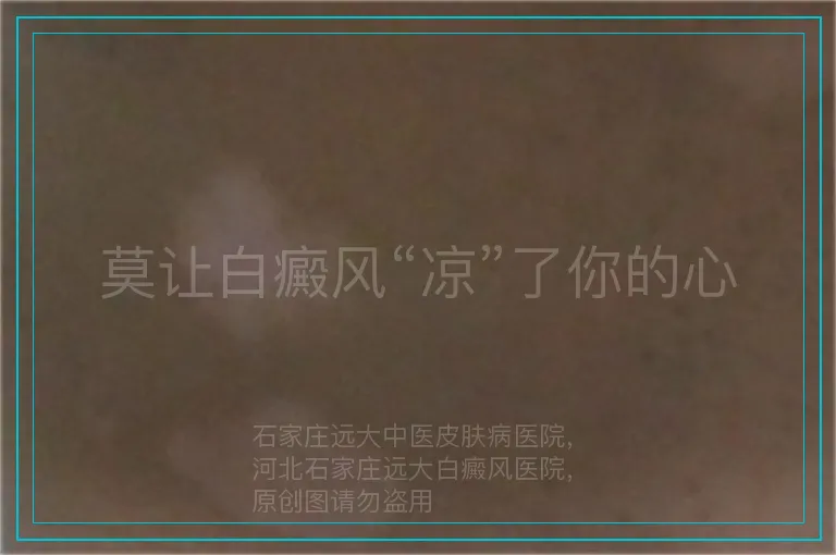 莫让白癜风“凉”了你的心