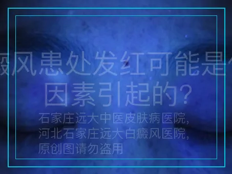 白癜风患处发红可能是什么因素引起的?