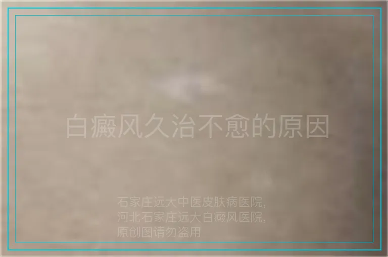 白癜风久治不愈的原因