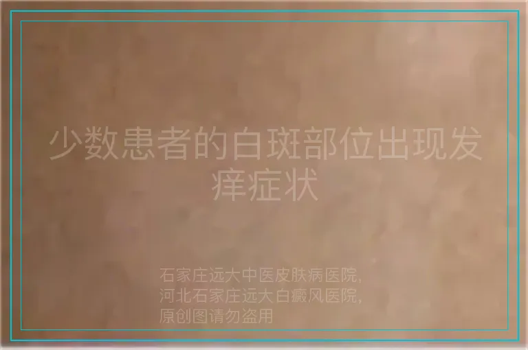 少数患者的白斑部位出现发痒症状