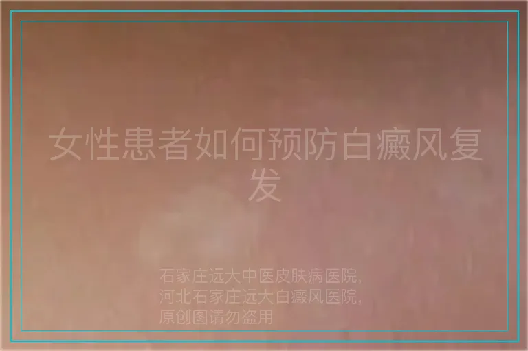 女性患者如何预防白癜风复发