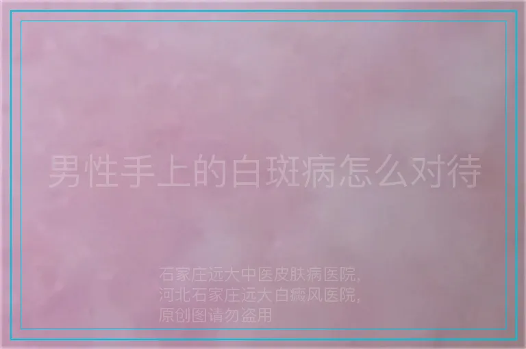 男性手上的白斑病怎么对待