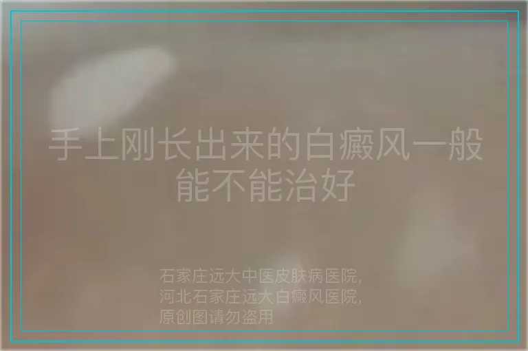 手上刚长出来的白癜风一般能不能治好