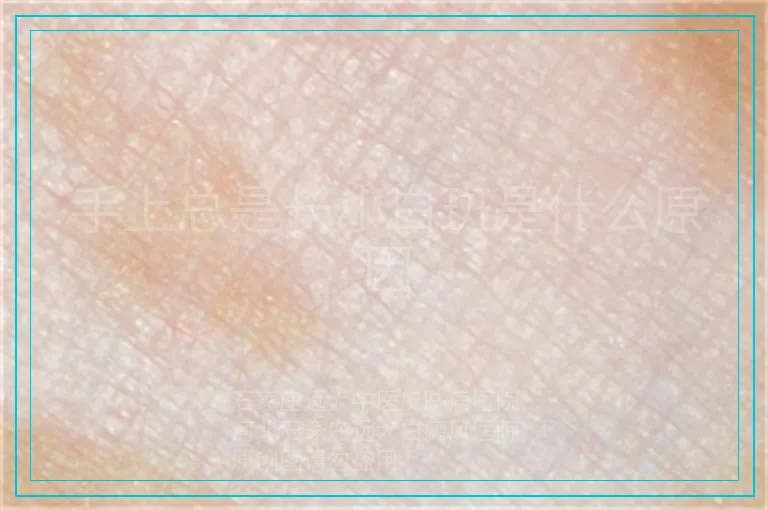 手上总是长小白斑是什么原因