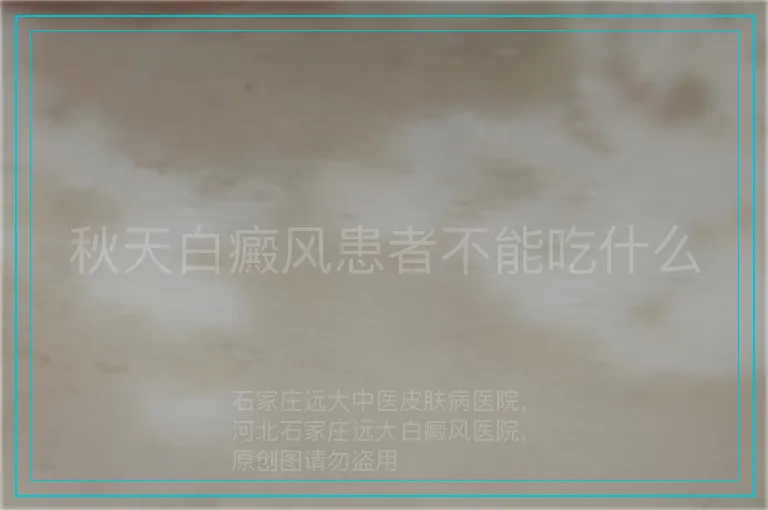 秋天白癜风患者不能吃什么