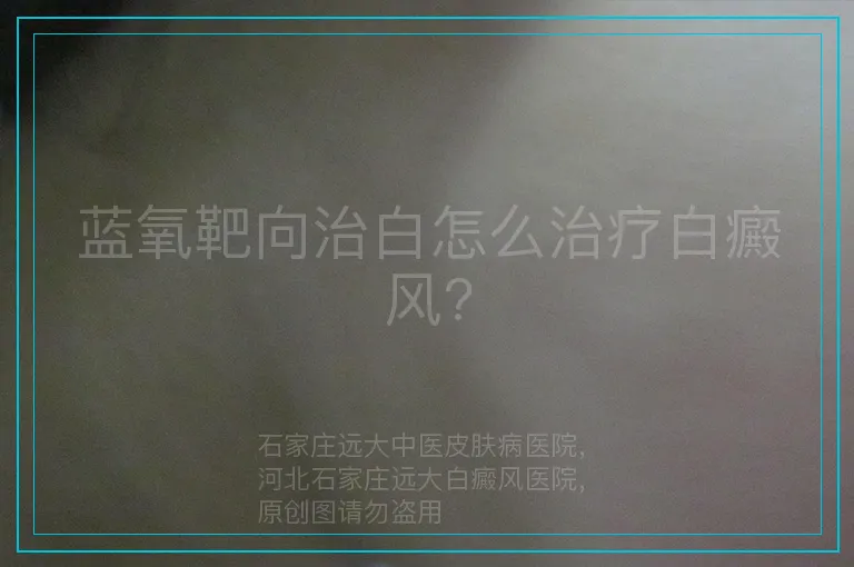 蓝氧靶向治白怎么治疗白癜风?
