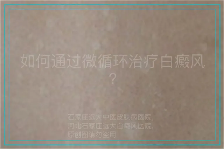 如何通过微循环治疗白癜风?