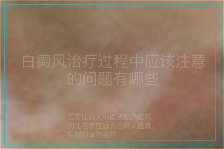 白癜风治疗过程中应该注意的问题有哪些