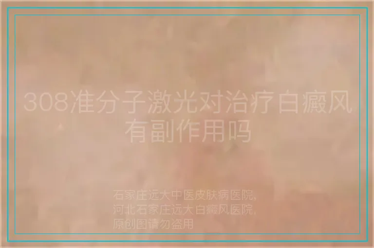 308准分子激光对治疗白癜风有副作用吗