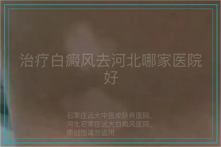 治疗白癜风去河北哪家医院好