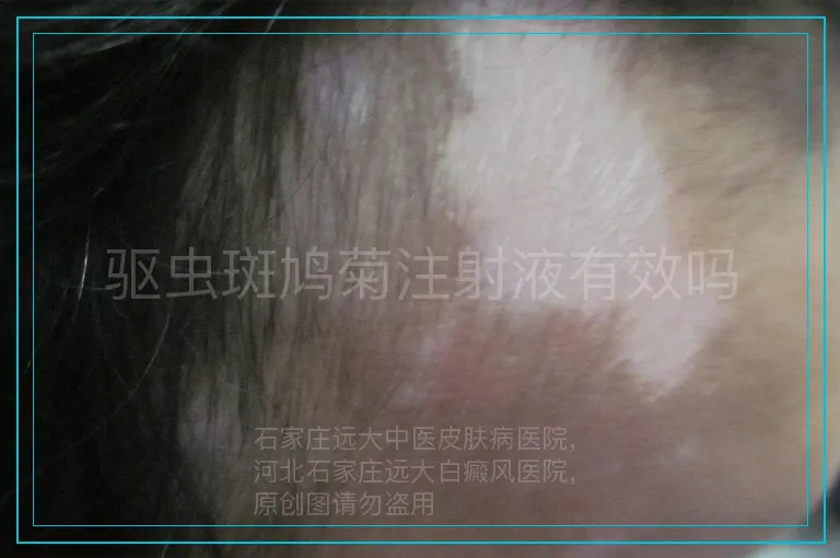 驱虫斑鸠菊注射液有效吗