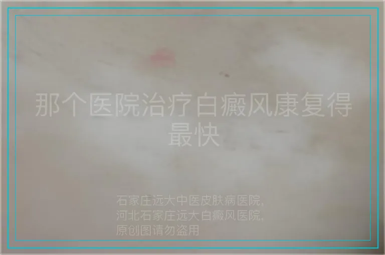 那个医院治疗白癜风康复得最快