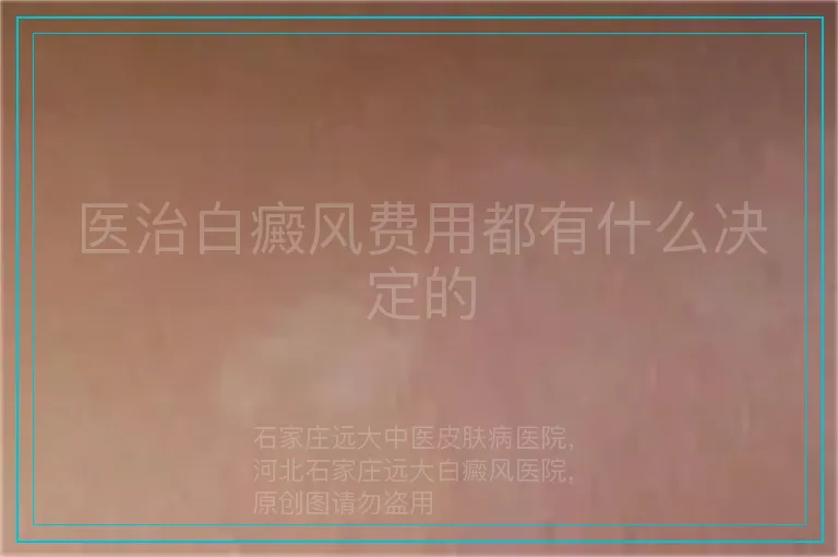 医治白癜风费用都有什么决定的
