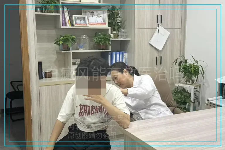 白癜风能有效医治吗