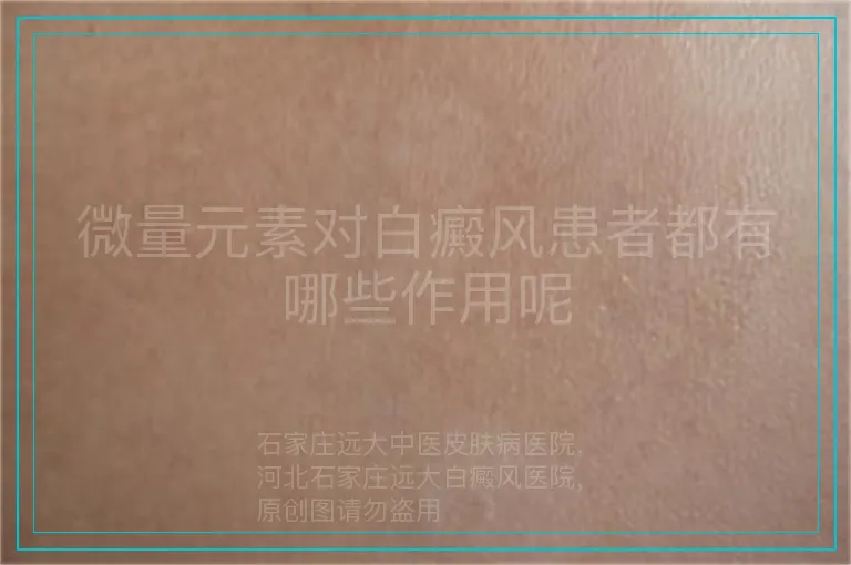 微量元素对白癜风患者都有哪些作用呢