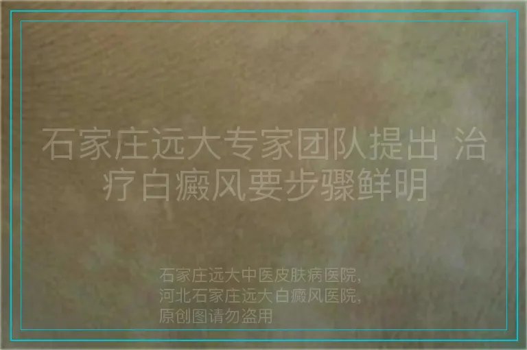 石家庄远大专家团队提出 治疗白癜风要步骤鲜明