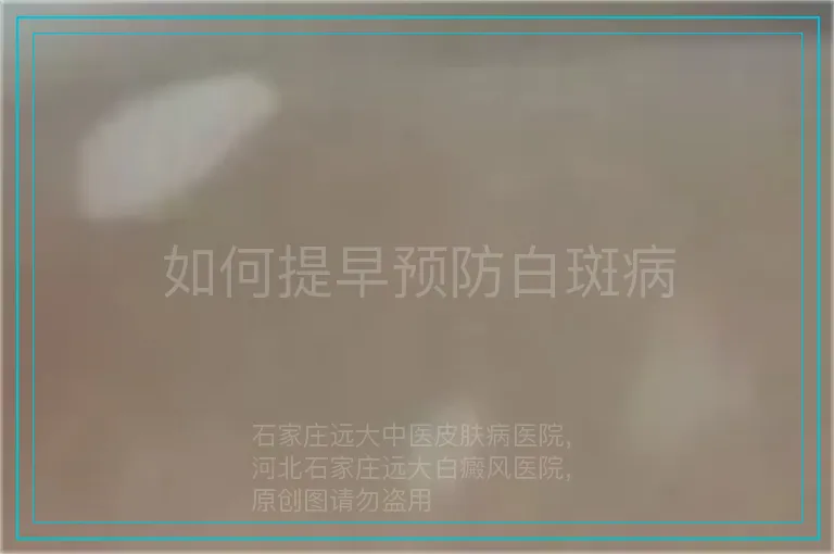 如何提早预防白斑病
